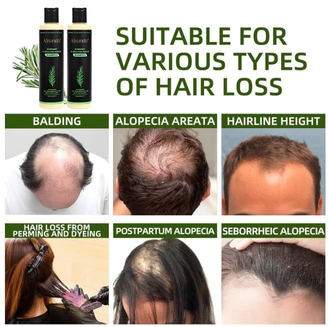🔥LAST DAY 70% OFF - 🎅Alisanda® Organic Rosemary Hair Growth Shampoo